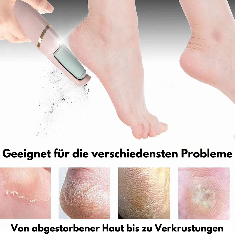 50% Rabatt | FeetCare™ - Hornhautentferner